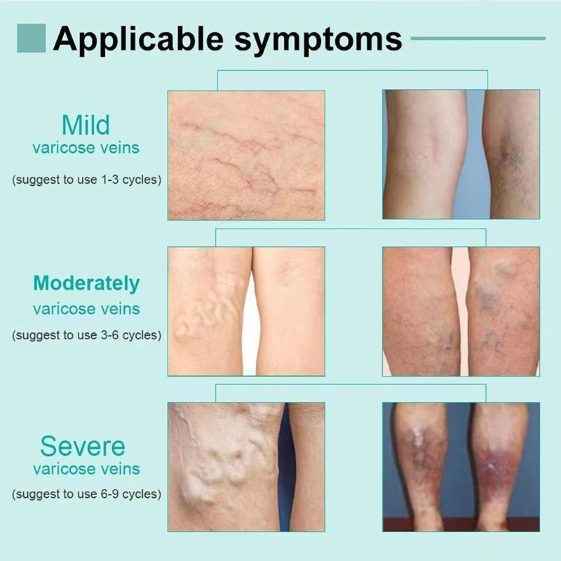 Spider Veins Removal Pen