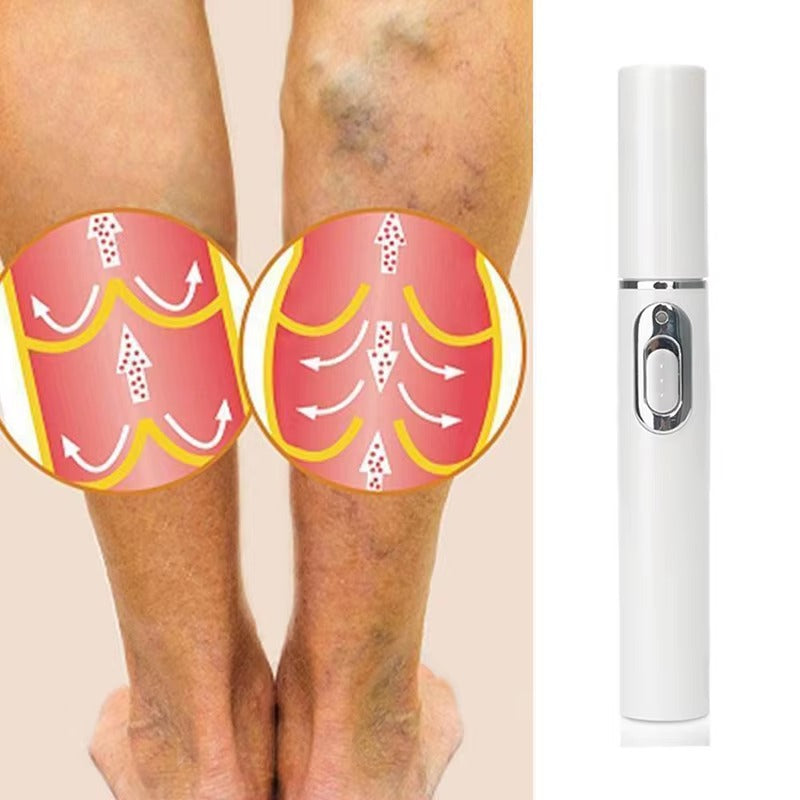 Spider Veins Removal Pen