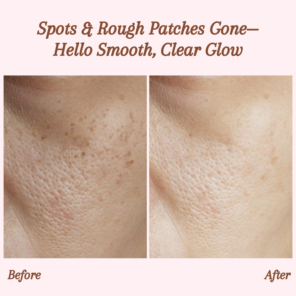 Radiant Silky Skin and Banish Flaws for Good 10101591114061-1