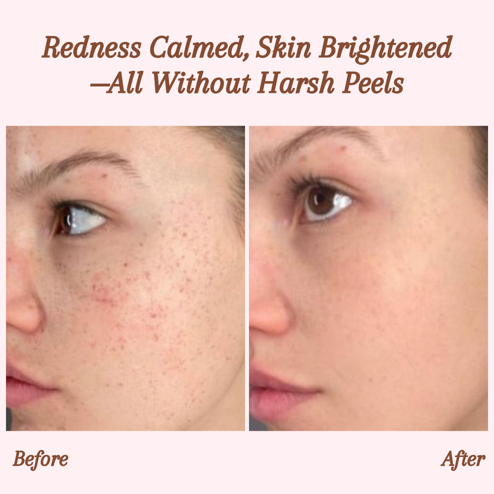 Radiant Silky Skin and Banish Flaws for Good 10101591114061-1