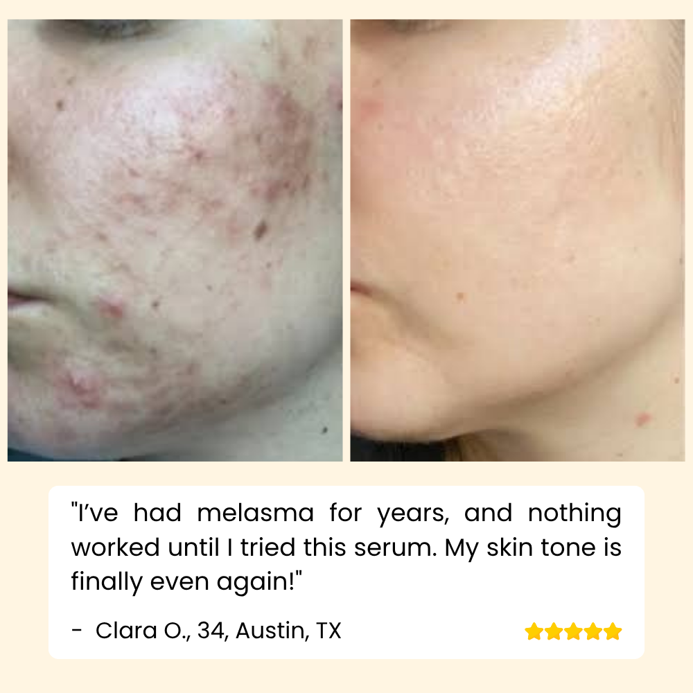 Erase Dark Spots Reveal Glowing Skin 10068614447437-1