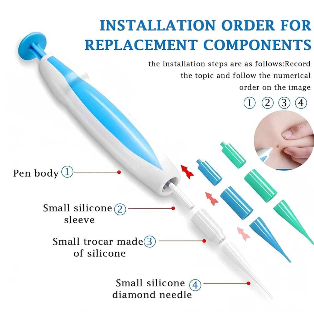 Zap Warts Fast and Unleash Your Radiant, Head-Turning Skin (FULL KIT)
