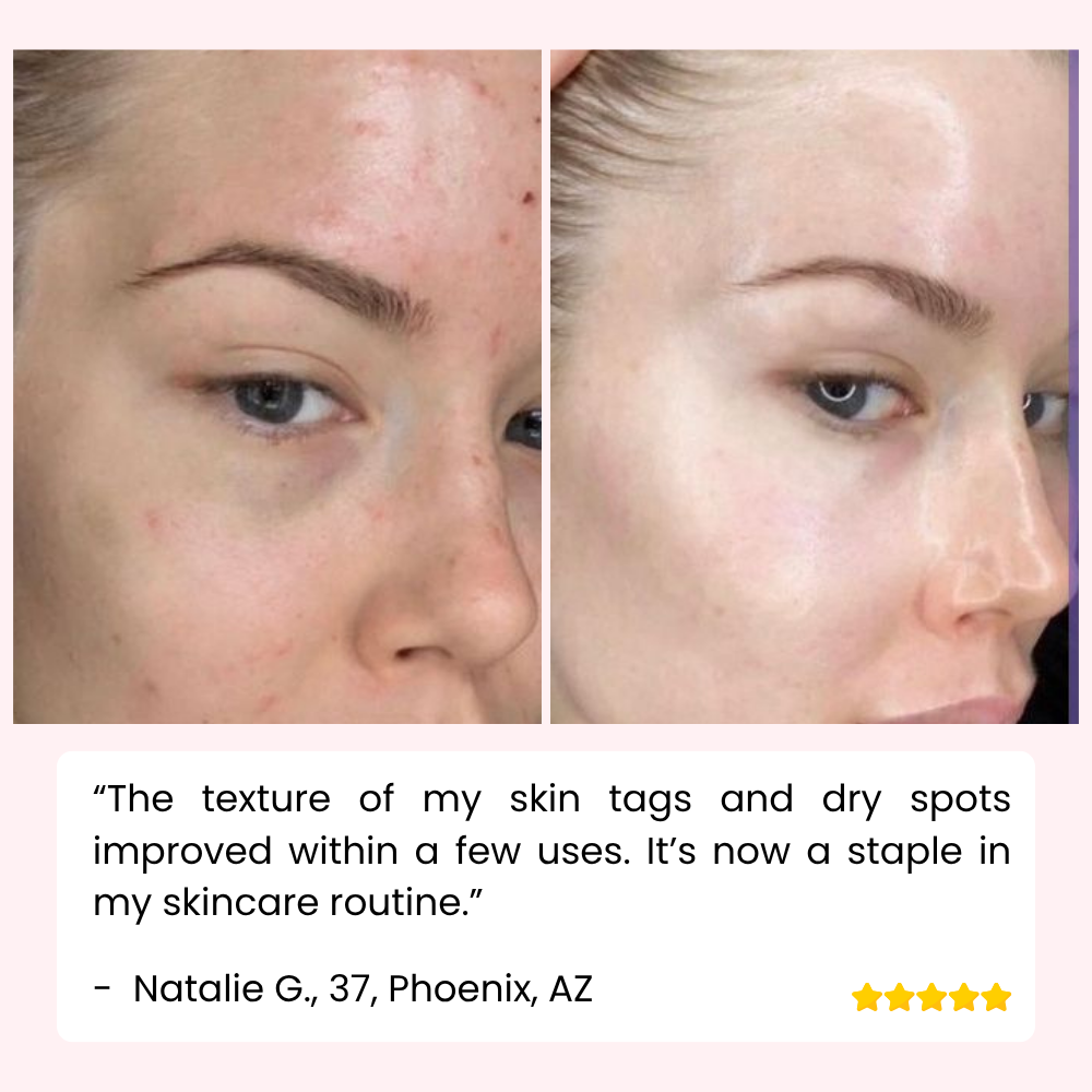 Radiant Silky Skin and Banish Flaws for Good 10101591114061-1