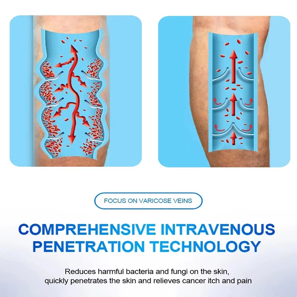 Spider Veins Removal Pen