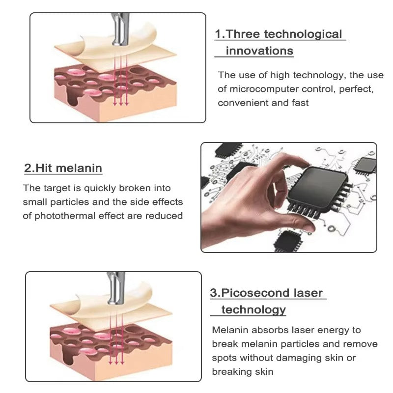 Laser Pen for Mole, Tattoo, Dark Spot, Acne Removal at Home