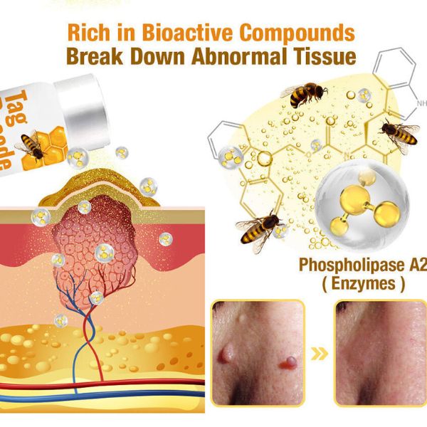 Bee Spray For Removing Warts And Moles 14981445255494-1