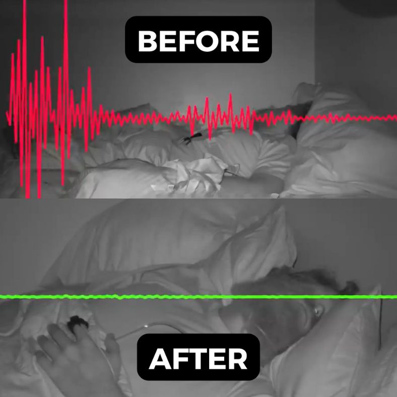 Anti-Snoring Jaw Support for Peaceful Sleep and Comfortable Breathing 15089480008006-1