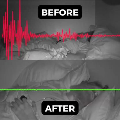 Anti-Snoring Jaw Support for Peaceful Sleep and Comfortable Breathing 15089480008006-1