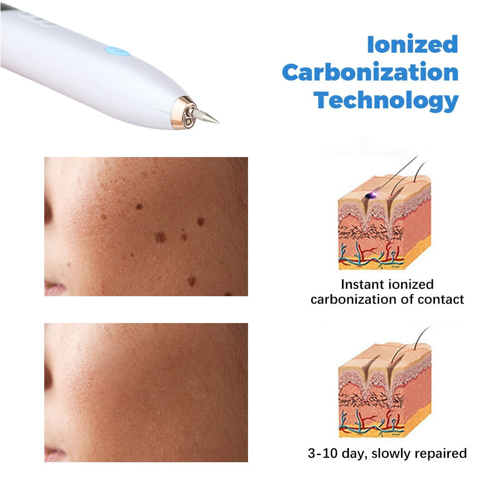 Plasma Mole &amp; Dark Spot Removal Pen