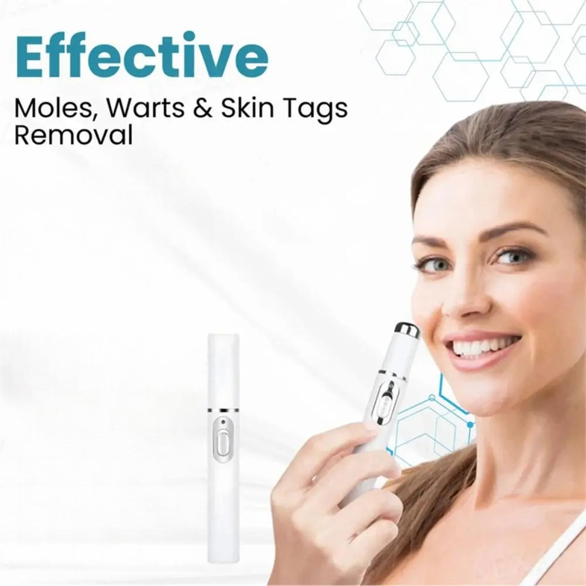 Non-Invasive Mole and Wart Removal Laser Pen
