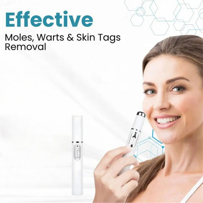 Non-Invasive Mole and Wart Removal Laser Pen
