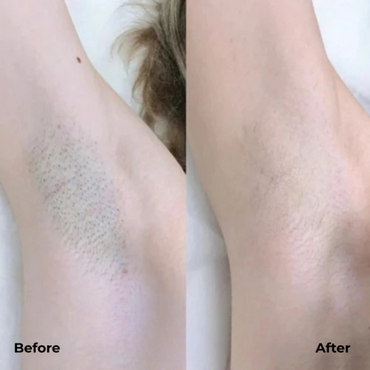 Electric Razor For Precision Shaving And Smooth Gentle Finish 15110572441926-1