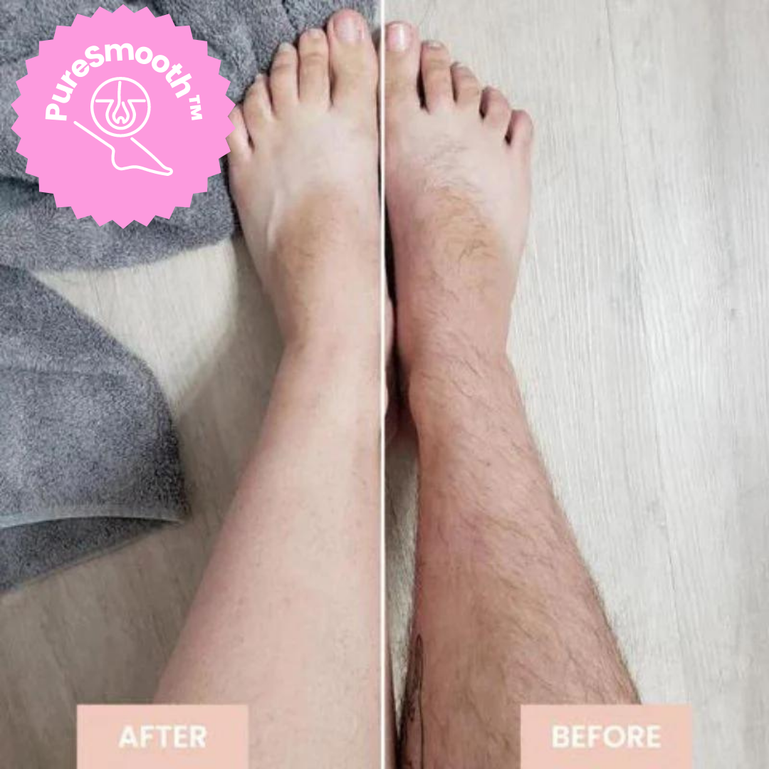 Gentle Hair Removal Device Smooth Skin Body Care Epilation Tool 9207731454278-1