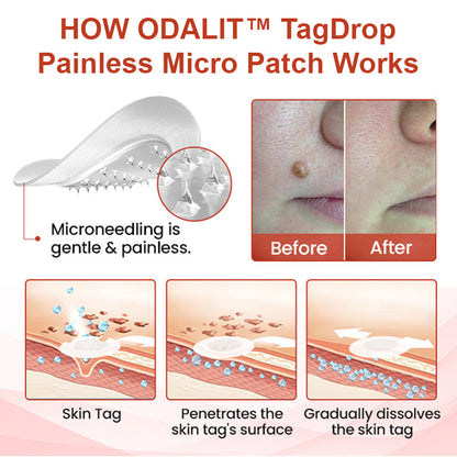 Painless Micro-Patch For Skin Tag, Mole & Wart Removal 12026003226942-1