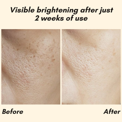 Erase Dark Spots Reveal Glowing Skin 10068614447437-1