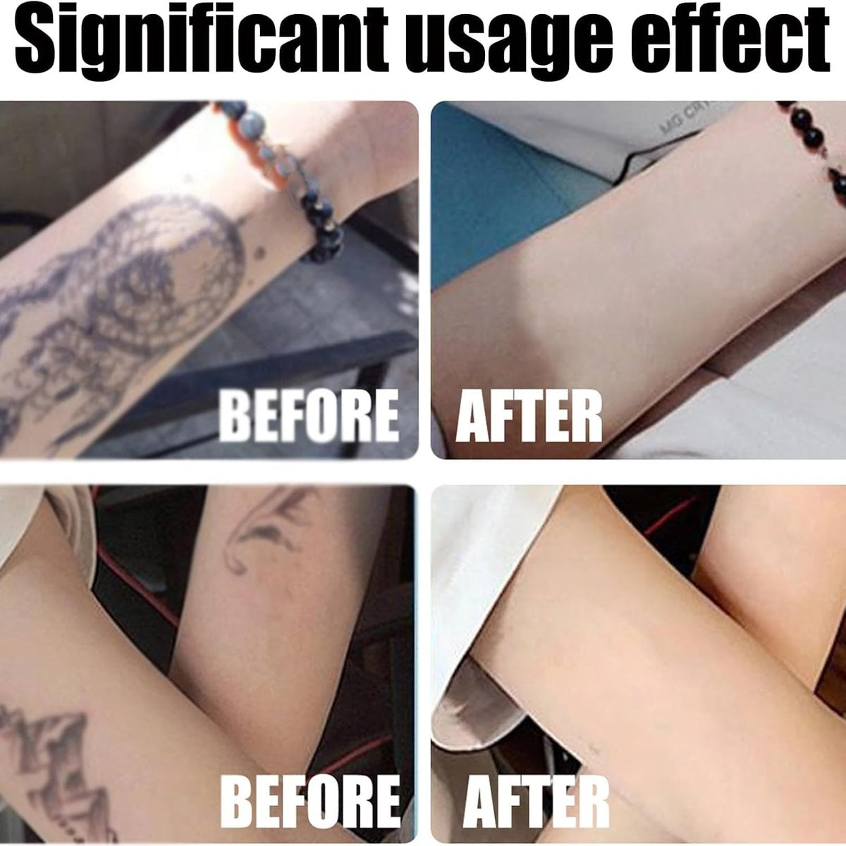 Tattoo Gone Removal Cream Fades Ink Restores Natural Clear Skin (30g)