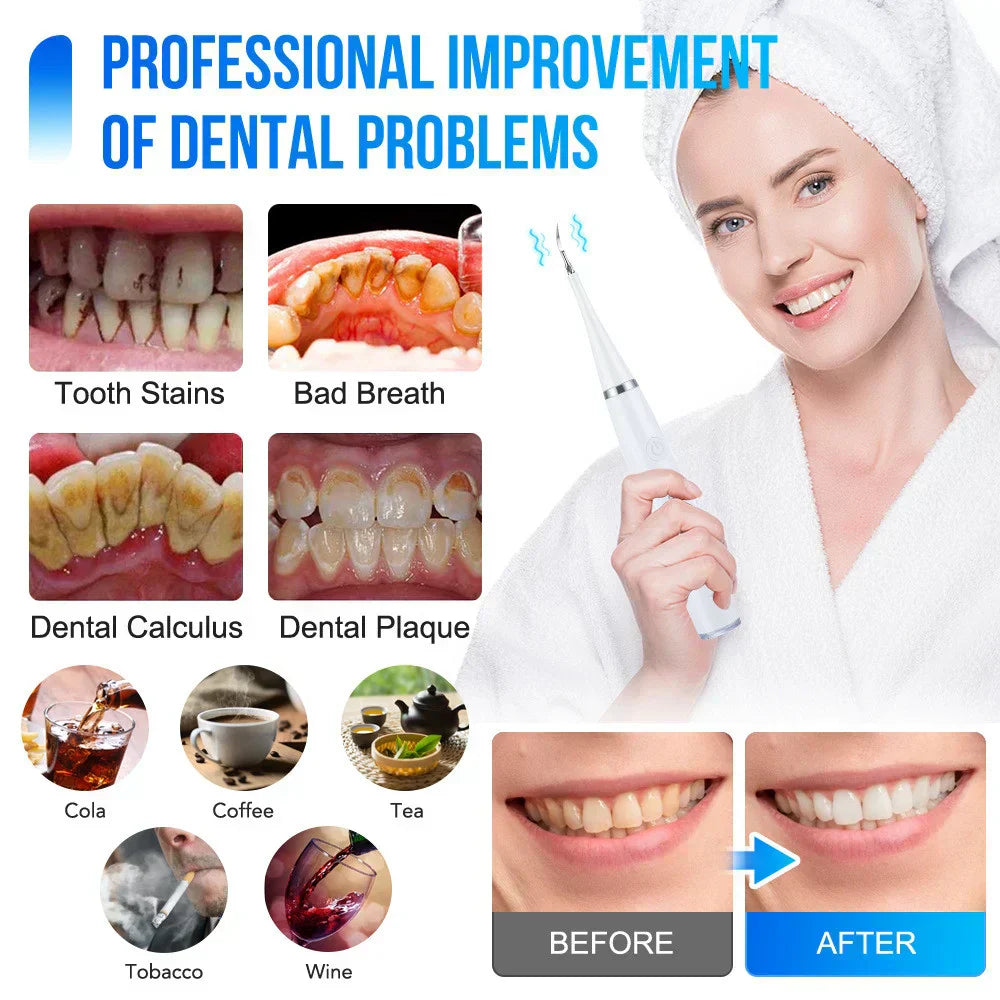 Smilepro | Professional Teeth Cleaning, Right At Home! 10368377389402-1