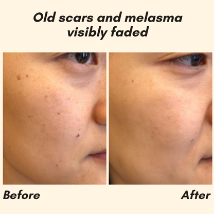 Erase Dark Spots Reveal Glowing Skin 10068614447437-1