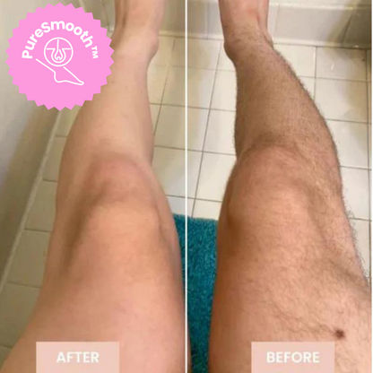 Gentle Hair Removal Device Smooth Skin Body Care Epilation Tool 9207731454278-1