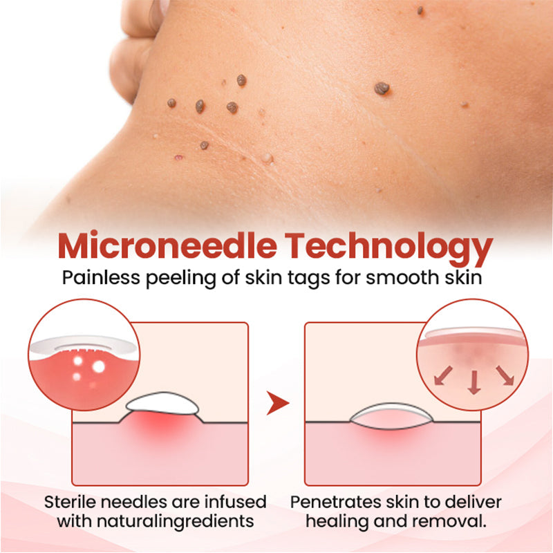 Painless Micro-Patch For Skin Tag, Mole & Wart Removal 12026003226942-1