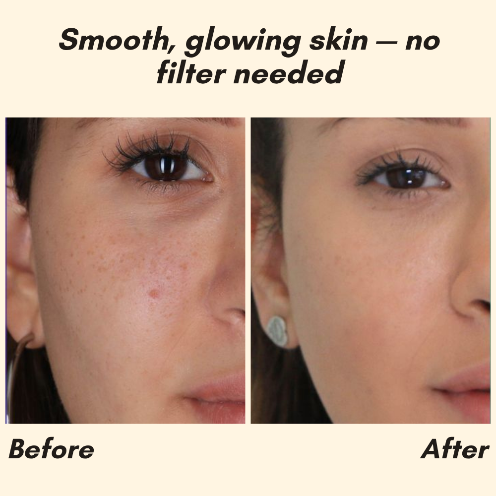 Erase Dark Spots Reveal Glowing Skin 10068614447437-1