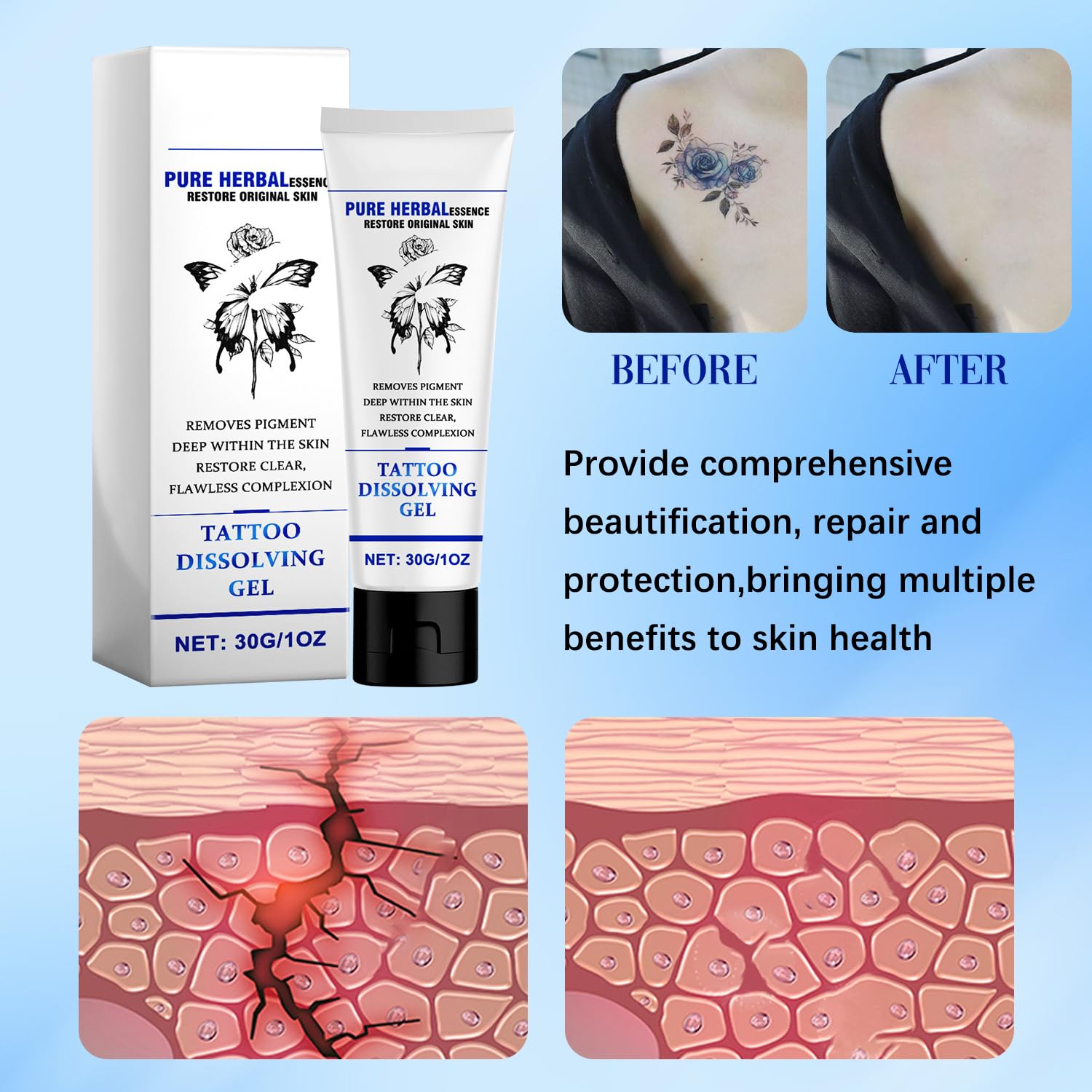 Tattoo Gone Removal Cream Fades Ink Restores Natural Clear Skin 14914338193734-1