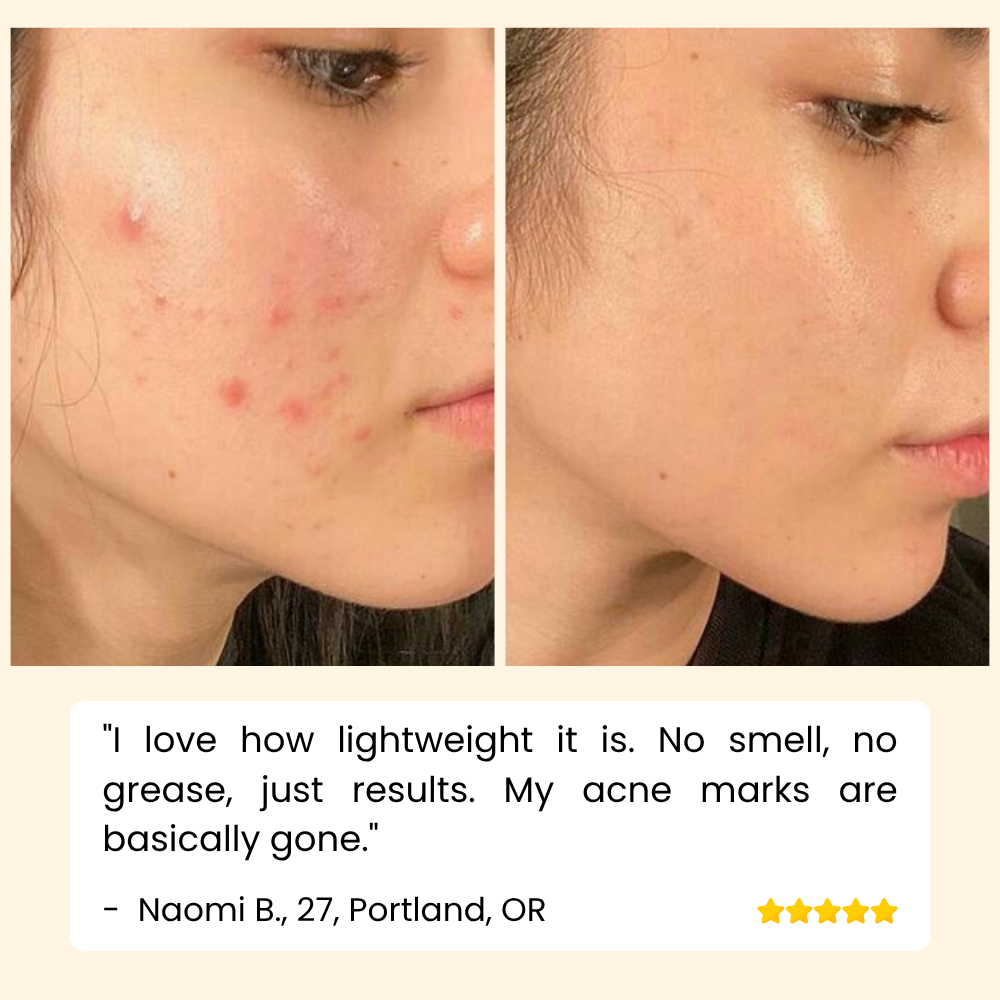 Erase Dark Spots Reveal Glowing Skin 10068614447437-1