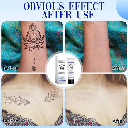 Tattoo Gone Removal Cream Fades Ink Restores Natural Clear Skin 14914338193734-1