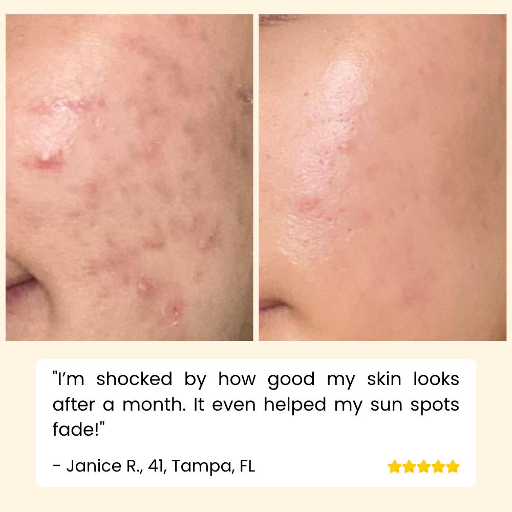 Erase Dark Spots Reveal Glowing Skin 10068614447437-1