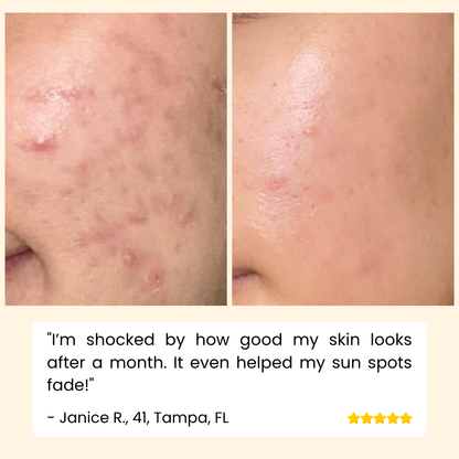 Erase Dark Spots Reveal Glowing Skin 10068614447437-1