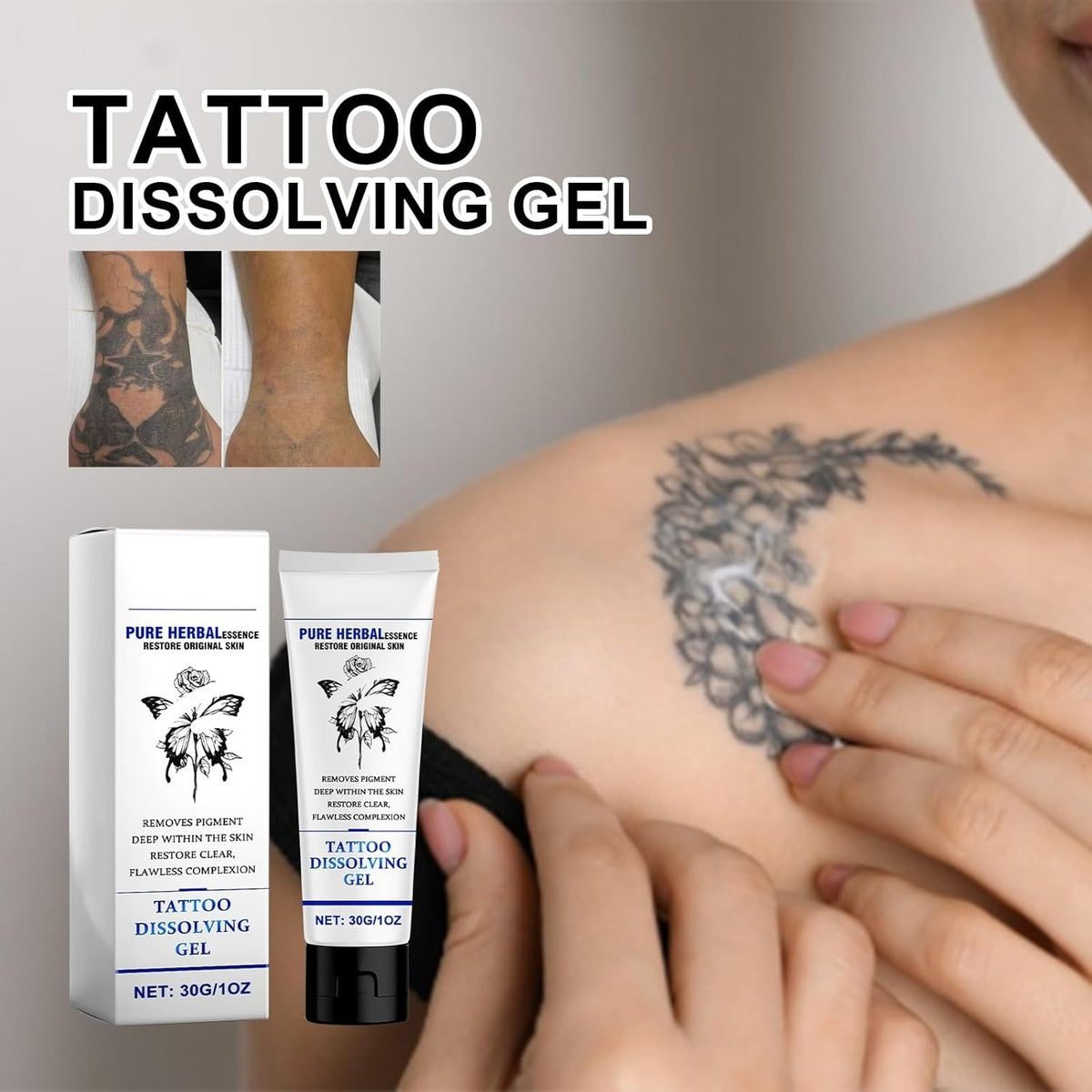 Tattoo Gone Removal Cream Fades Ink Restores Natural Clear Skin (30g)