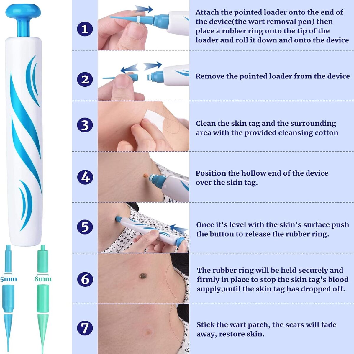 Zap Warts Fast and Unleash Your Radiant, Head-Turning Skin (FULL KIT)