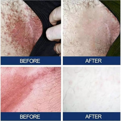 Men’s Herbal Care Cream – Gentle Daily Hygiene Formula (20g)