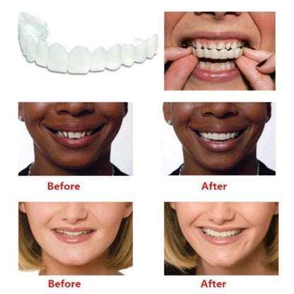 Dental Aligner For Whitening Teeth And Invisible Orthodontic Comfort