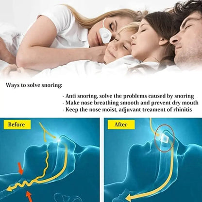 Electric Atomized Micro-Cpap - Portable Electric Anti Snoring Devices Smart Anti Snoring Device