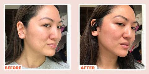 Microcurrent Light Therapy 6-In-1 Skin Care Device 9967691727194-1