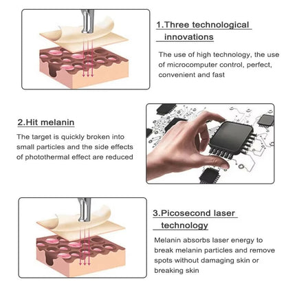 Laser Pen for Mole, Tattoo, Dark Spot, Acne Removal at Home
