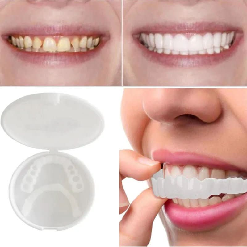 Snapfit Smile - Tooth Restoration For A Perfect Smile Without A Visit To The Dentist 10452804501768-1