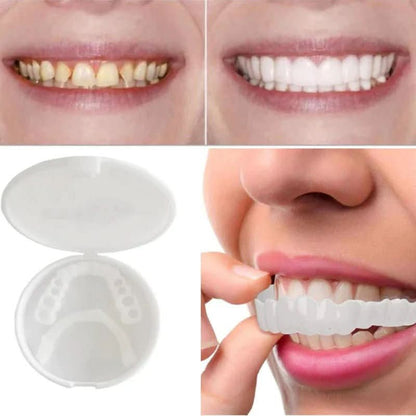 Snapfit Smile - Tooth Restoration For A Perfect Smile Without A Visit To The Dentist 10452804501768-1