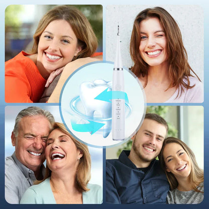 Smilepro | Professional Teeth Cleaning, Right At Home! 10368377389402-1