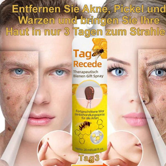 Bee Spray For Removing Warts And Moles 14981445255494-1