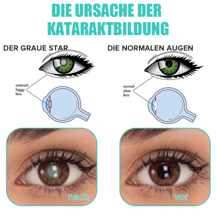 Hydrating Eye Drops for Refreshing and Soothing Tired, Dry Eyes 15058711609670-1