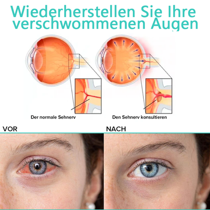 Hydrating Eye Drops for Refreshing and Soothing Tired, Dry Eyes 15058711609670-1