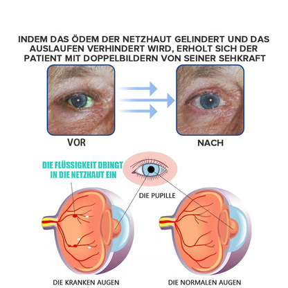 Hydrating Eye Drops for Refreshing and Soothing Tired, Dry Eyes 15058711609670-1