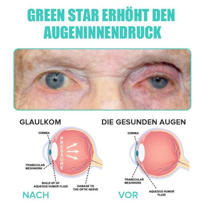 Hydrating Eye Drops for Refreshing and Soothing Tired, Dry Eyes 15058711609670-1