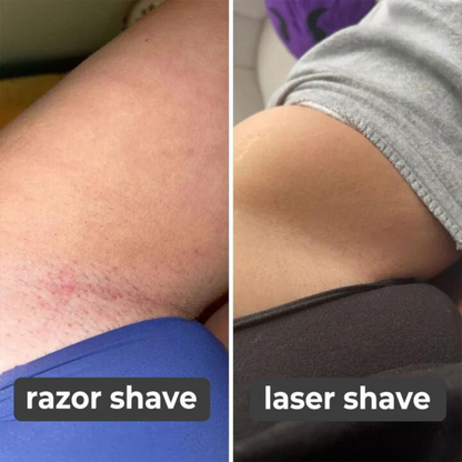 Laser Hair Remover Rechargeable Painless Device Smooth Skin Technology 14901560049990-1