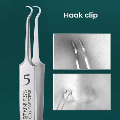 Skincare Tool For Targeted Blemish Removal And Clear Smooth Skin 15101088366918-1