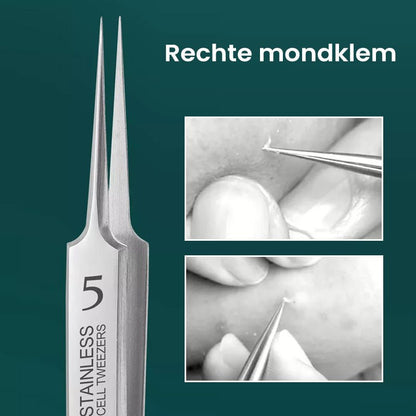 Skincare Tool For Targeted Blemish Removal And Clear Smooth Skin 15101088366918-1