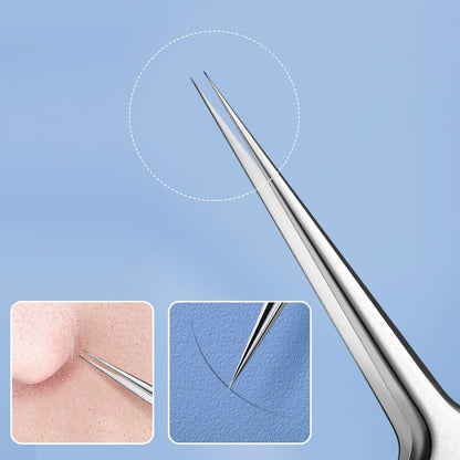 Skincare Tool For Targeted Blemish Removal And Clear Smooth Skin 15101088366918-1
