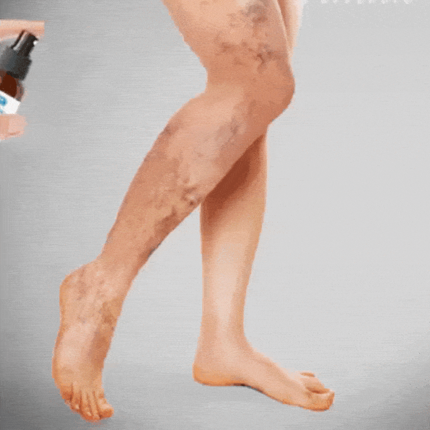 Fast Joint & Varicose Vein Pain Relief Spray 10788165648718-1